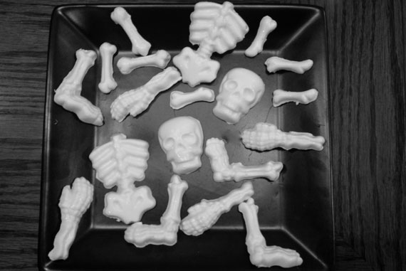 Bone molds